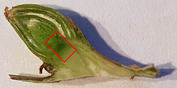 tissue to get extracted